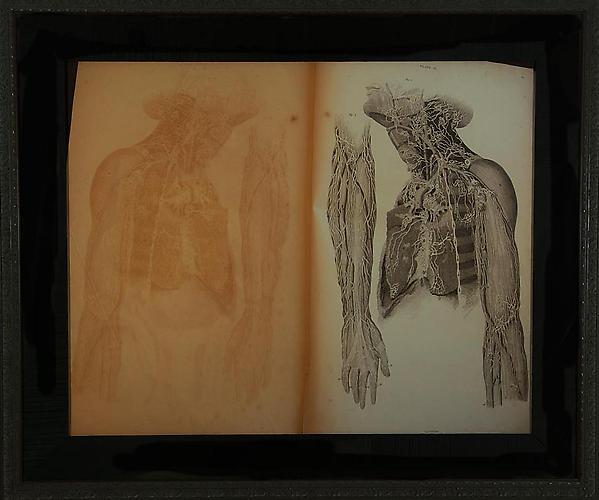 CINDY STELMACKOWICH | MOURNING III | ULTRACHROMIUM PRINT | 50 X 40 INCHES | 2010
