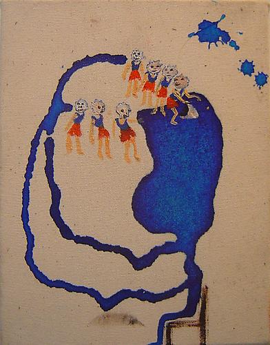 Blue Spot on Human Hands