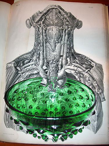 CINDY STELMACKOWICH | BLINDED BY SCIENCE: GREEN | C-PRINT | 24 X 32 INCHES | 2006