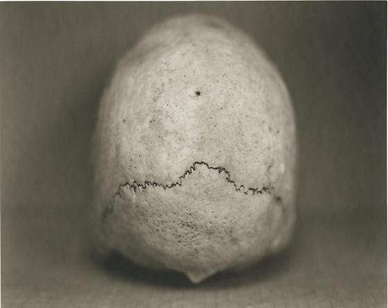 A17: Male, 36 Years Old, 2000