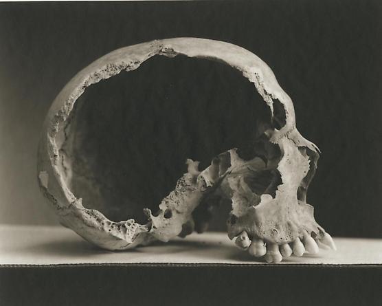 C18: Male, 36 Years Old, 2000