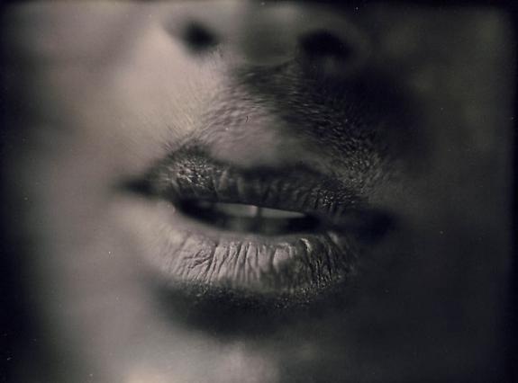 Anatomical Detail #34, 2001