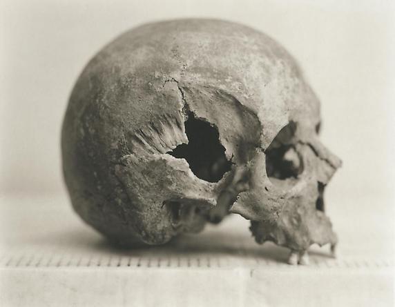 C4: Male, 39 Years Old, 2000