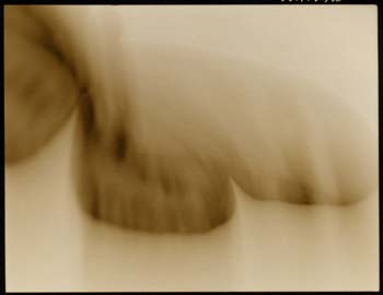 Insect #19, 2000