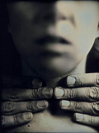 Anatomical Detail #17, 2001