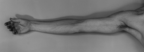 <i>Self Portrait</i>, 1976