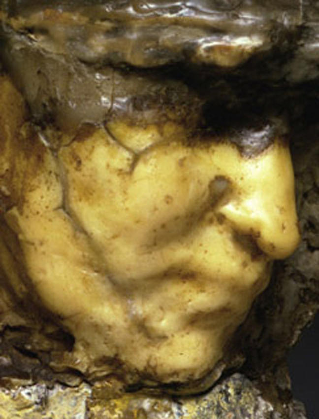 Medardo Rosso<br />[detail] Carne altrui   <br />1883<br />