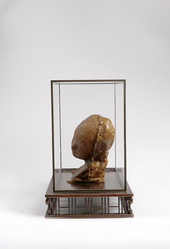 Medardo Rosso<br />Bambino malato<br />c. 1895<br />